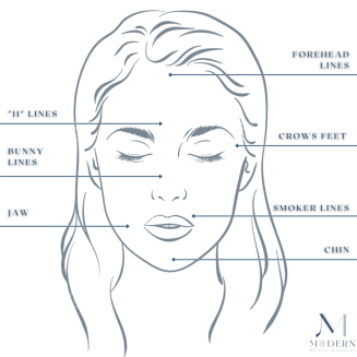 The Most Common Areas For Botox And Why? SLC Utah